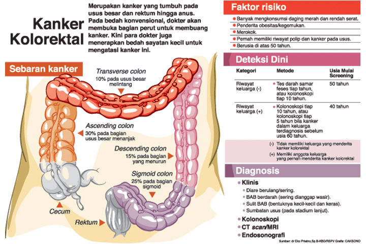 Sayatan Kecil Atasi Kanker Usus Besar