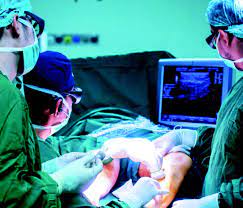 Varises Bisa Sebabkan Kematian Mendadak