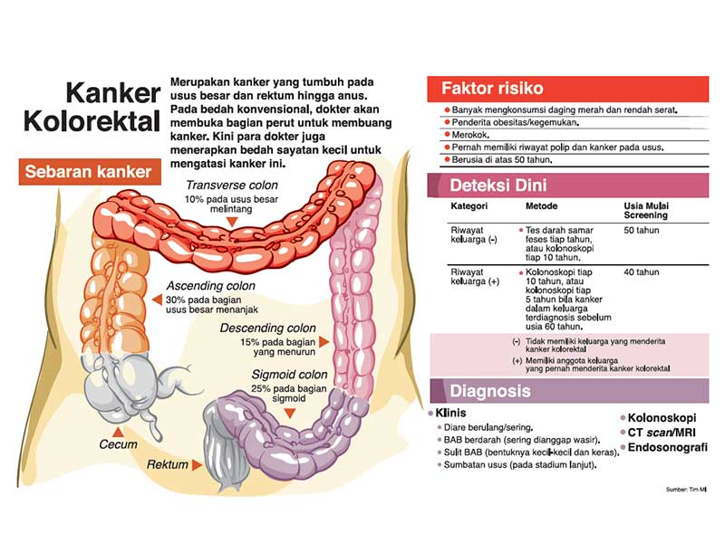 Gaya Hidup Picu Kanker Kolorektal
