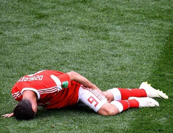 Alan Dzagoev cedera hamstring dalam pertandingan perdana Piala Dunia, Rusia melawan Arab Saudi, Kamis (14/6).
