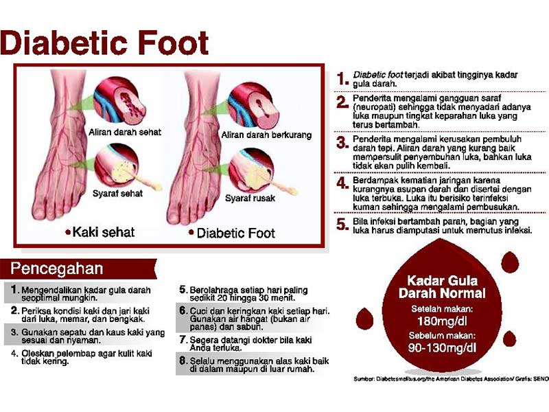 DKI Jakarta Wilayah Tertinggi Prevalensi Diabetes