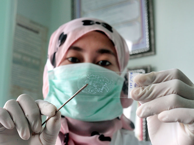 PENANGANAN TUBERKULOSIS INDONESIA: JAKARTA, 13/4 - PENANGANAN TUBERKULOSIS INDONESIA. Seorang petugas tengah memeriksa sampel dahak pasien d