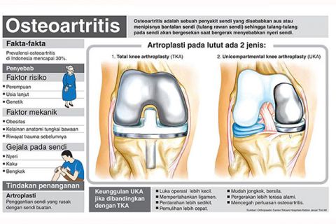 Osteoartritis, Nyeri karena Ausnya Bantalan Sendi