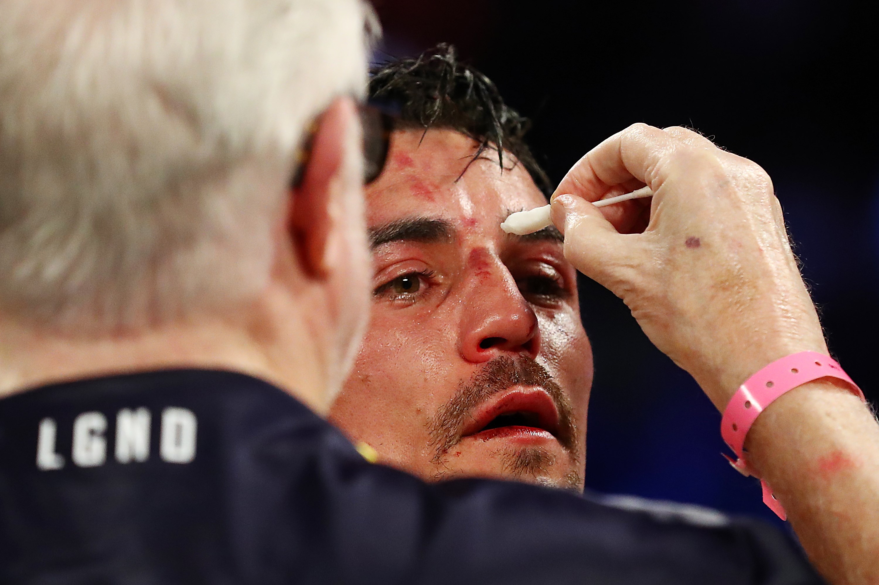 PETINJU Anthony Crolla