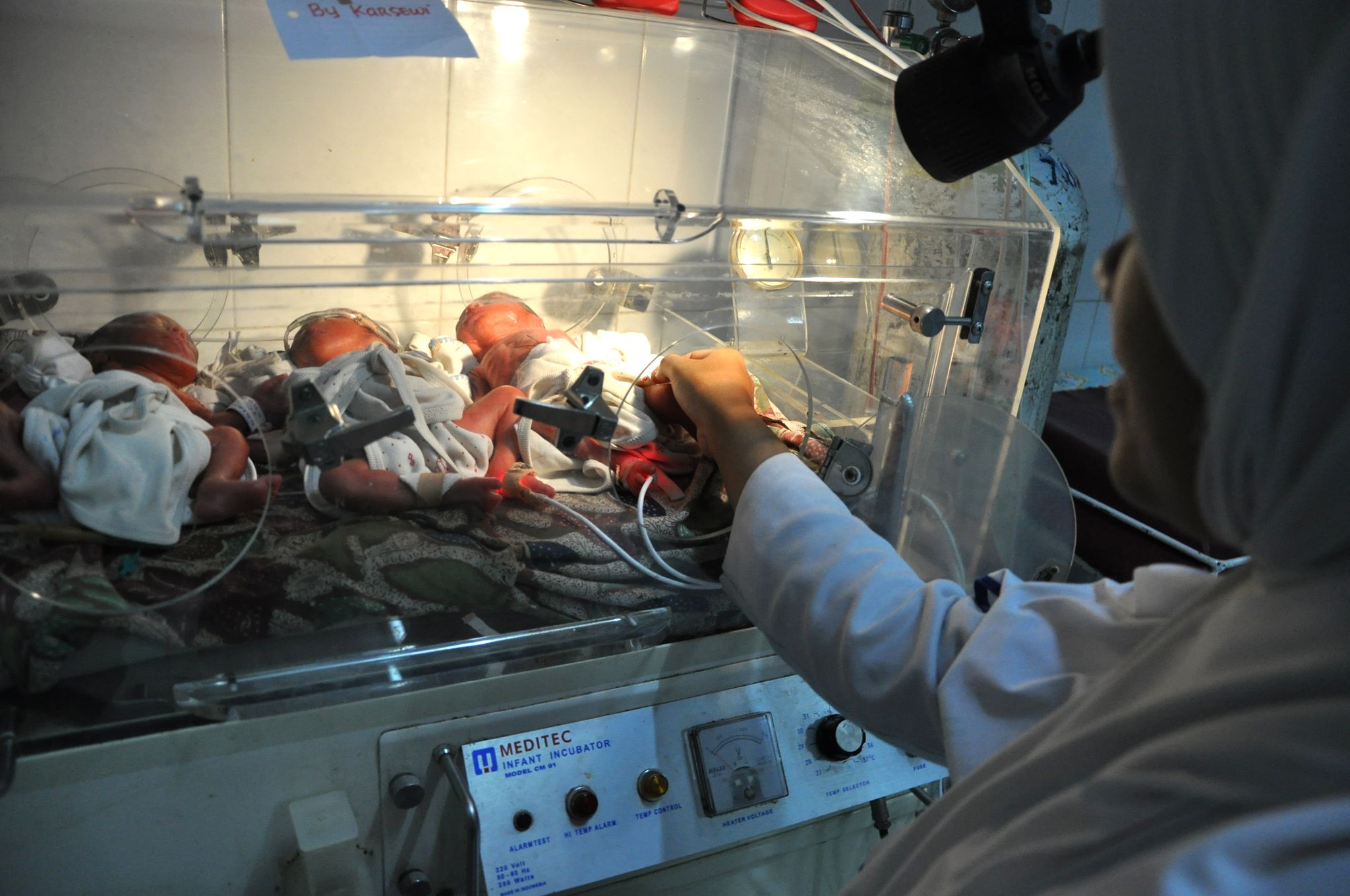 Kurang Gizi, Bayi  Arjuna Lahir Abnormal 