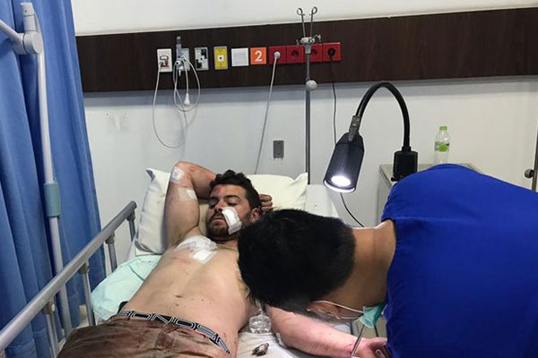 WN Australia Viral Mengamuk di Kuta Ditetapkan Jadi Tersangka