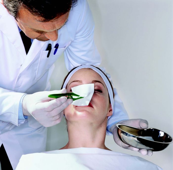 Rhinoplasty, Agar Hidung Lebih Mancung