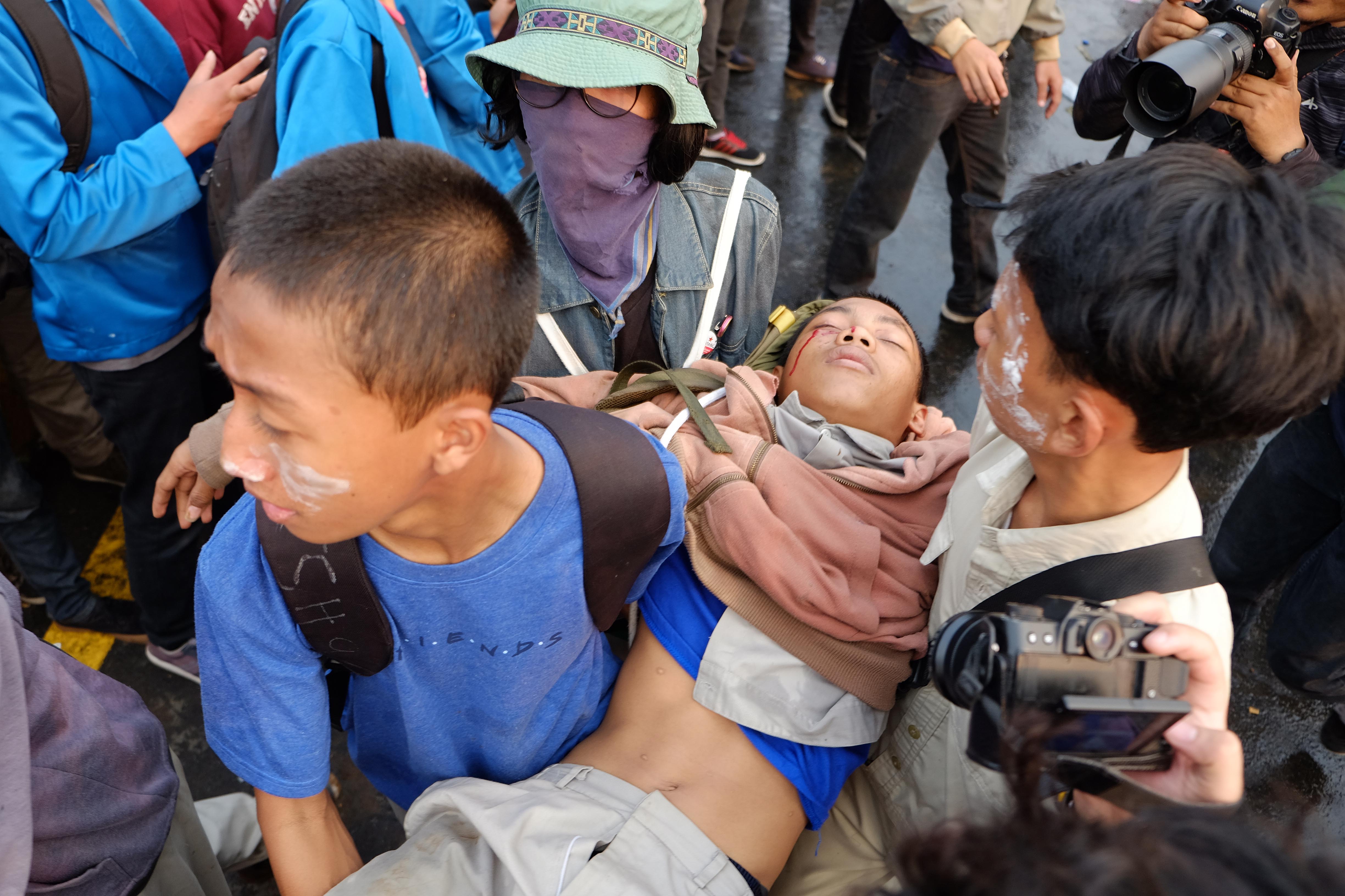 Mahasiswa terluka saat berdemonstrasi di depan gedung DPR/MPR