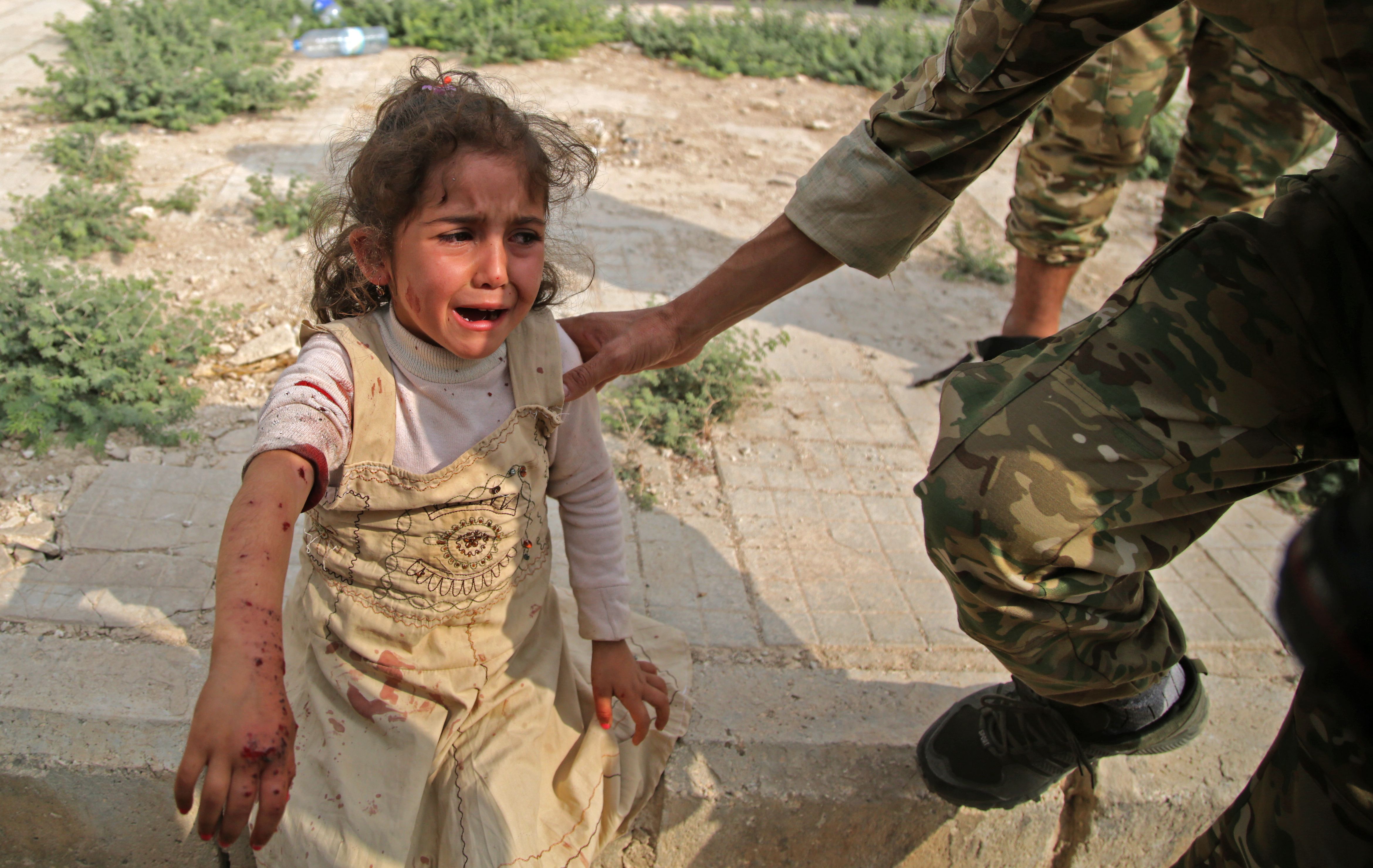 Seorang anak Suriah menangis menahan sakit karena luka-lukanya, di Suriah, Minggu (20/10).