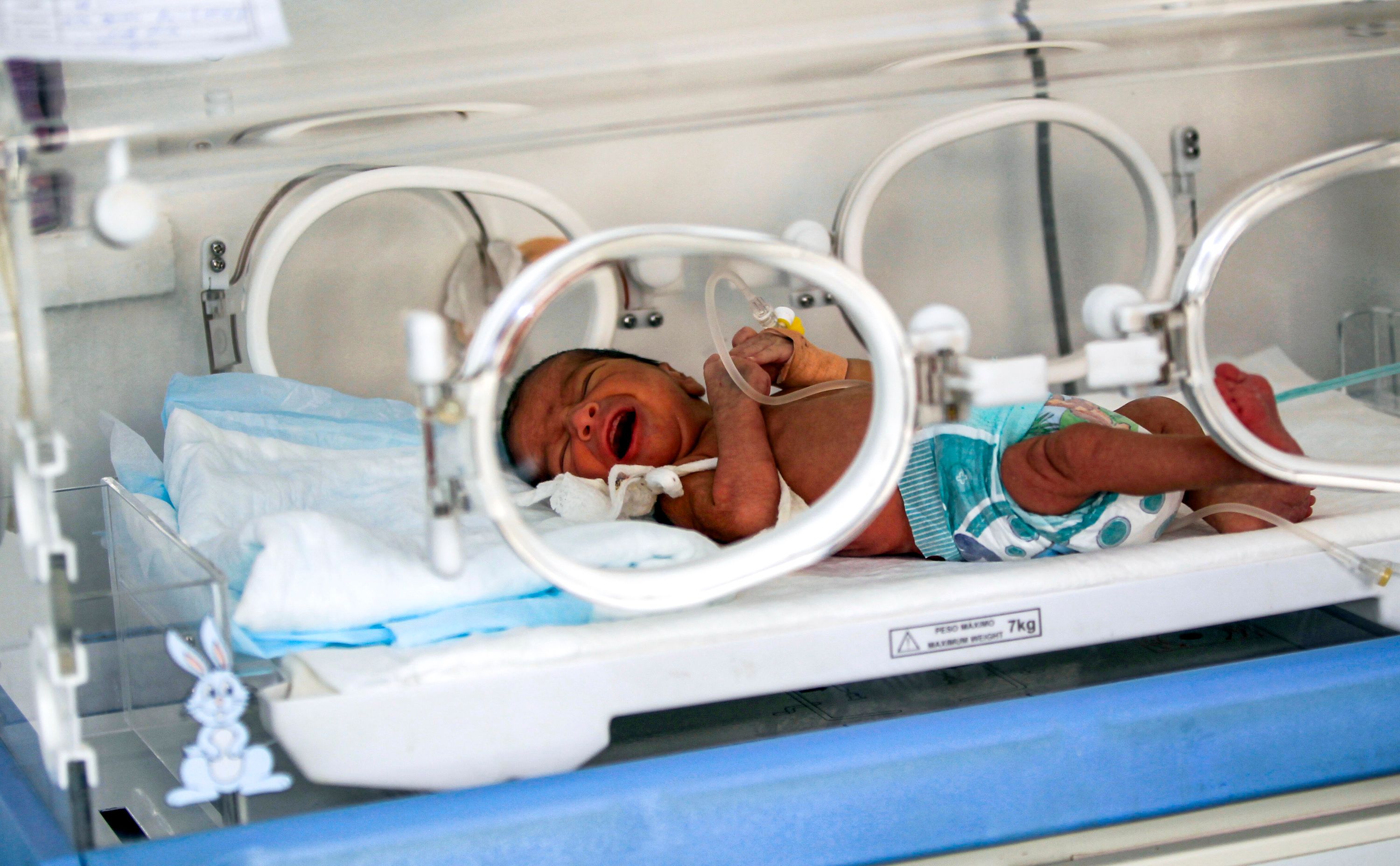 Bayi yang dirawat  intensif di fasilitas Neonatal Intensive Care Unit (NICU) tetap mendapat air susu ibu (AS).  