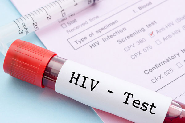 Wah, Ratusan Warga Tegal Terserang HIV