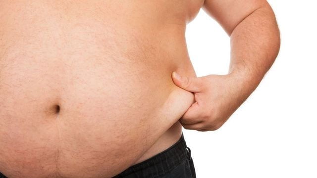 Obesitas Perburuk Risiko Alami Gangguan Pengapuran Sendi Lutut