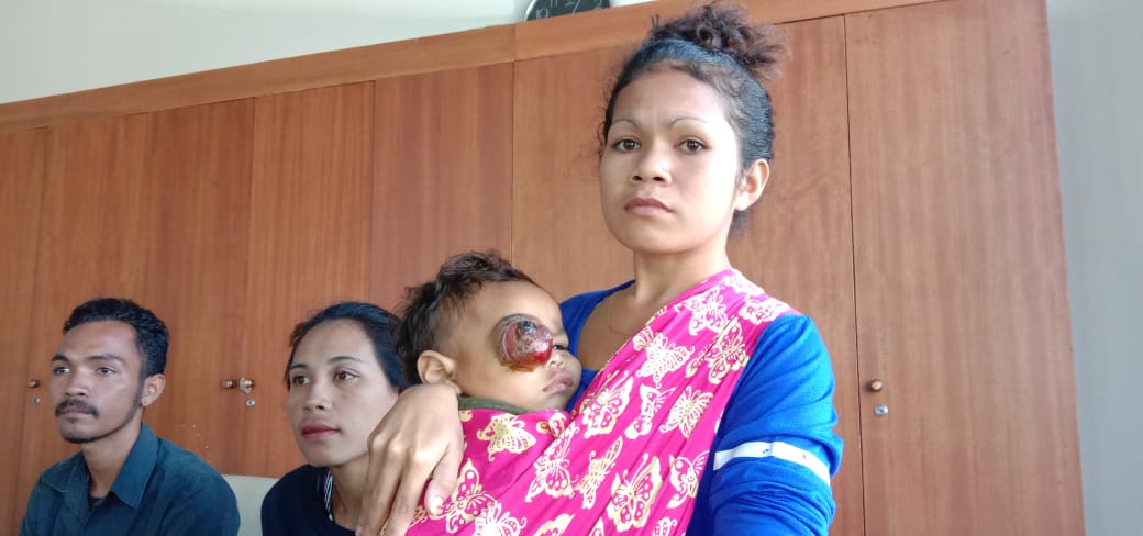 Theofanus Rifki Sandi, balita berusia 22 bulan, asal Wejangkalo, Manggarai, NTT menderita tumor mata dan membutuhkan bantuan.