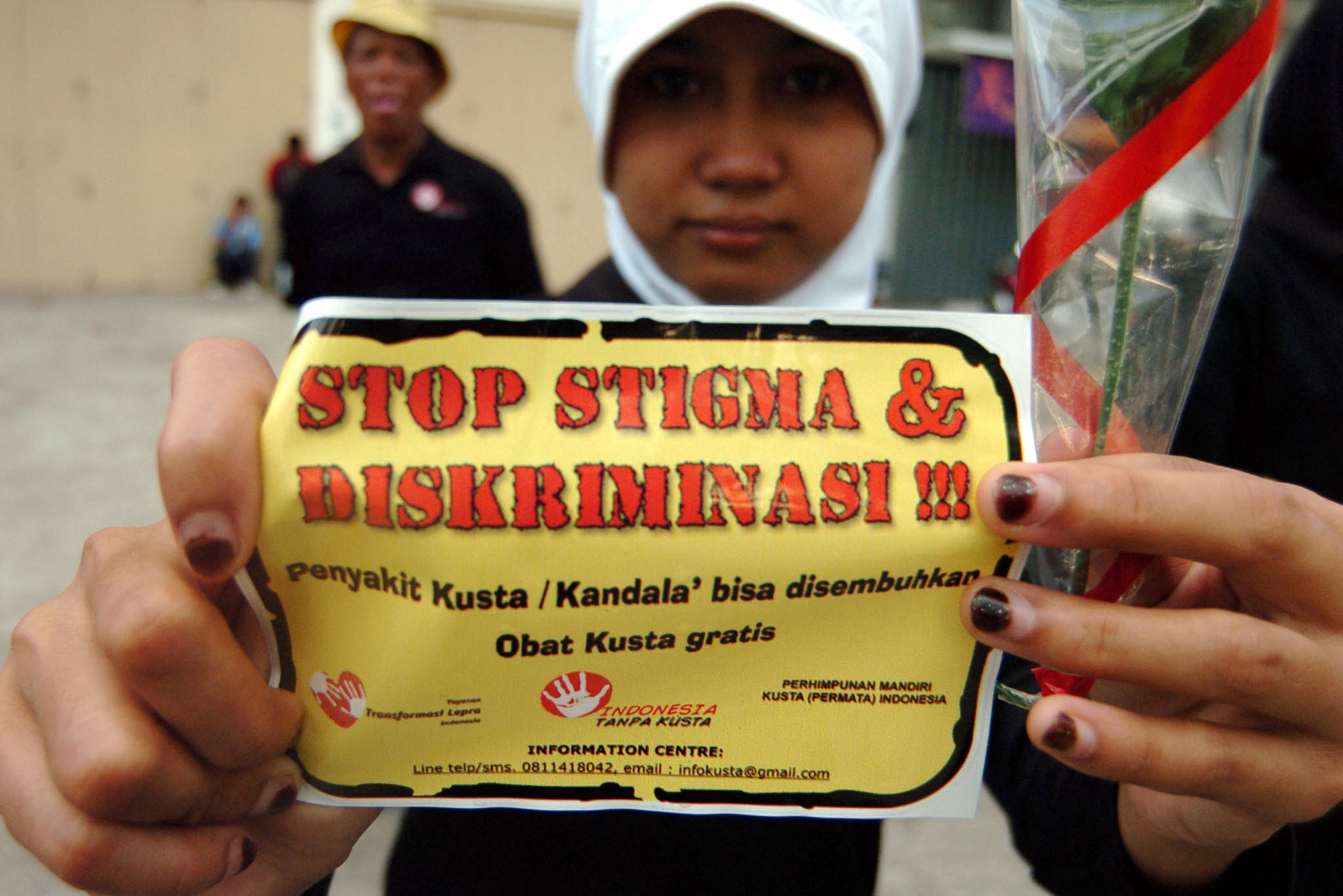 Penderita kusta di Indonesia hingga kini masih mendapat perlakuan diskriminatif, termasuk anak-anak penderita kusta ikut terkena imbasnya.