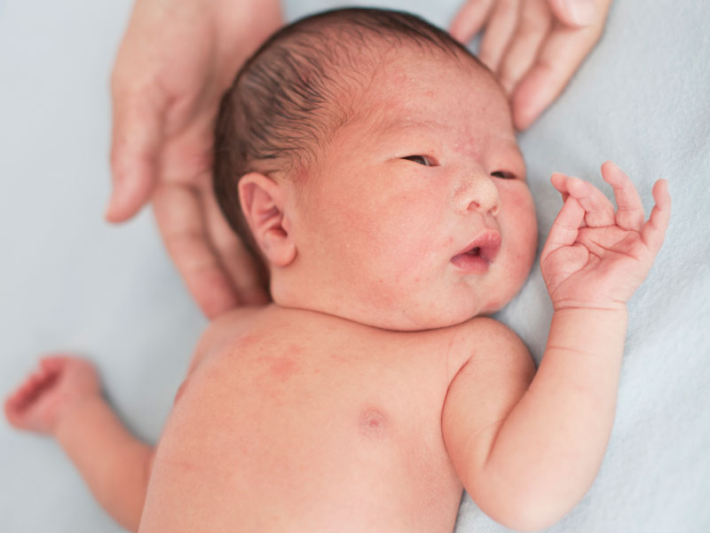 Diberi Makan Pisang, Bayi 40 Hari Tewas