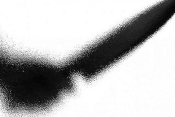 Oknum TNI yang Melakukan Penusukan Sudah Ditahan