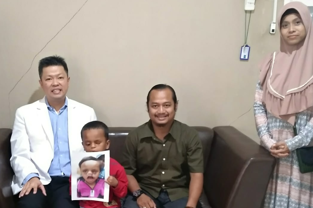 Dokter RS Siloam Sukses Tangani Kasus Langka Bibir Sumbing Wajah