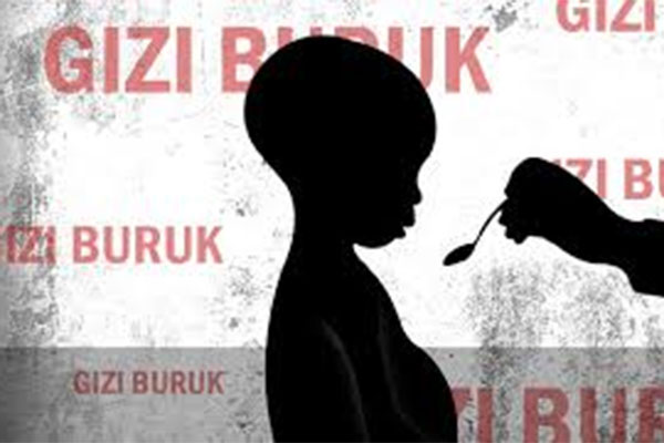 Gizi Buruk