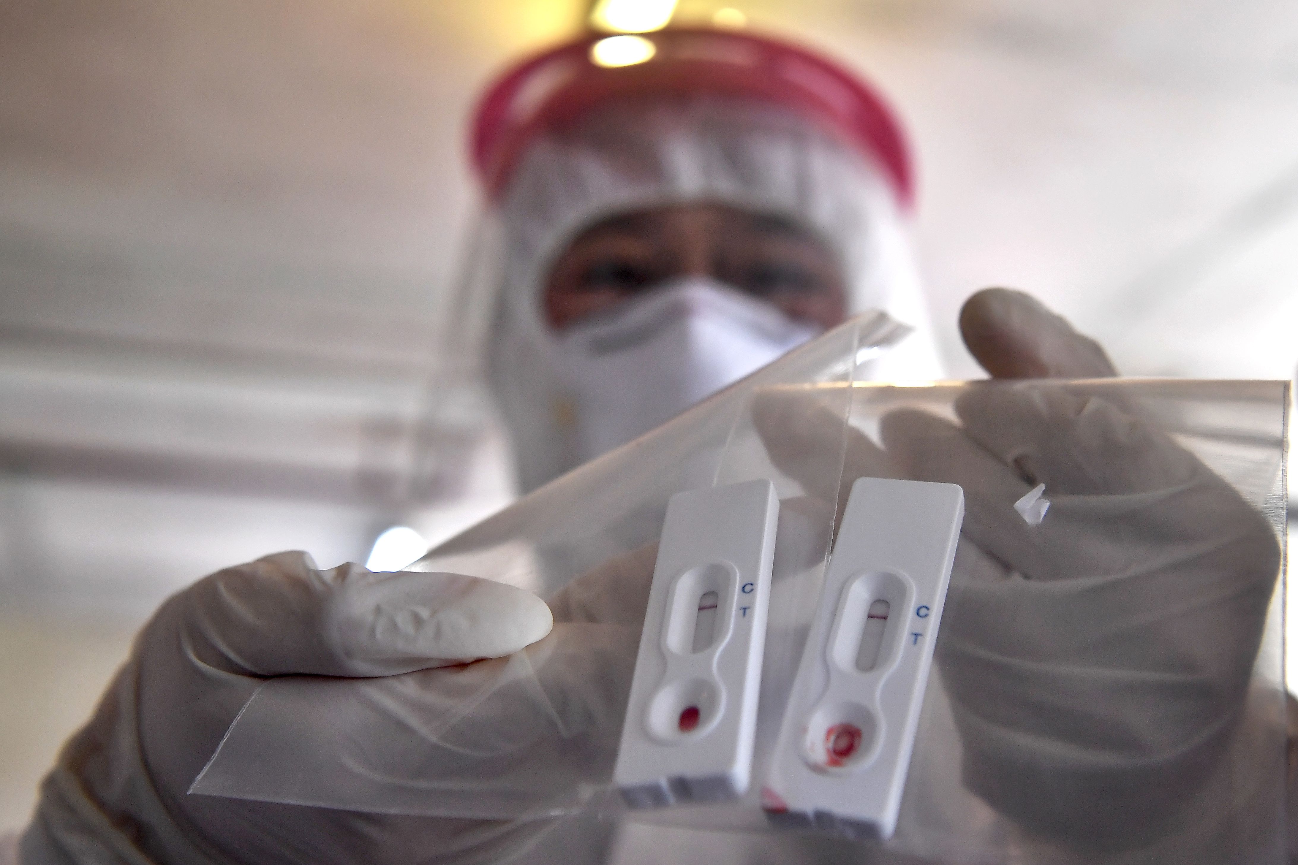 Seorang staf kesehatan memperlihatkan alat uji Covid-19 terbaru di Chulalongkorn University, Bangkok, Thailand.