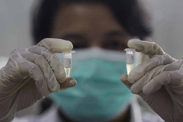 Ilustrasi : penelitian virus korona.