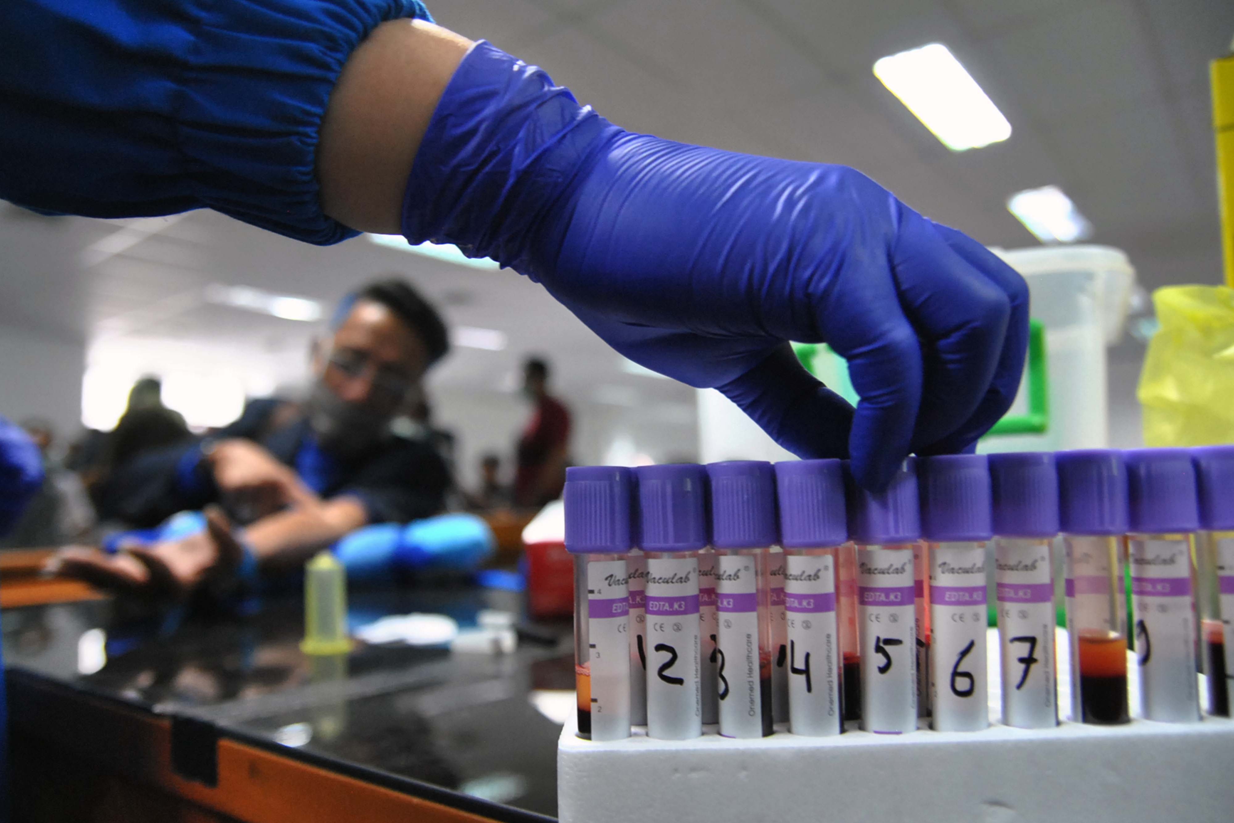 Sampel darah pemeriksaan kesehatan anggota DPRD Kota Bogor, beberapa waktu lalu. 