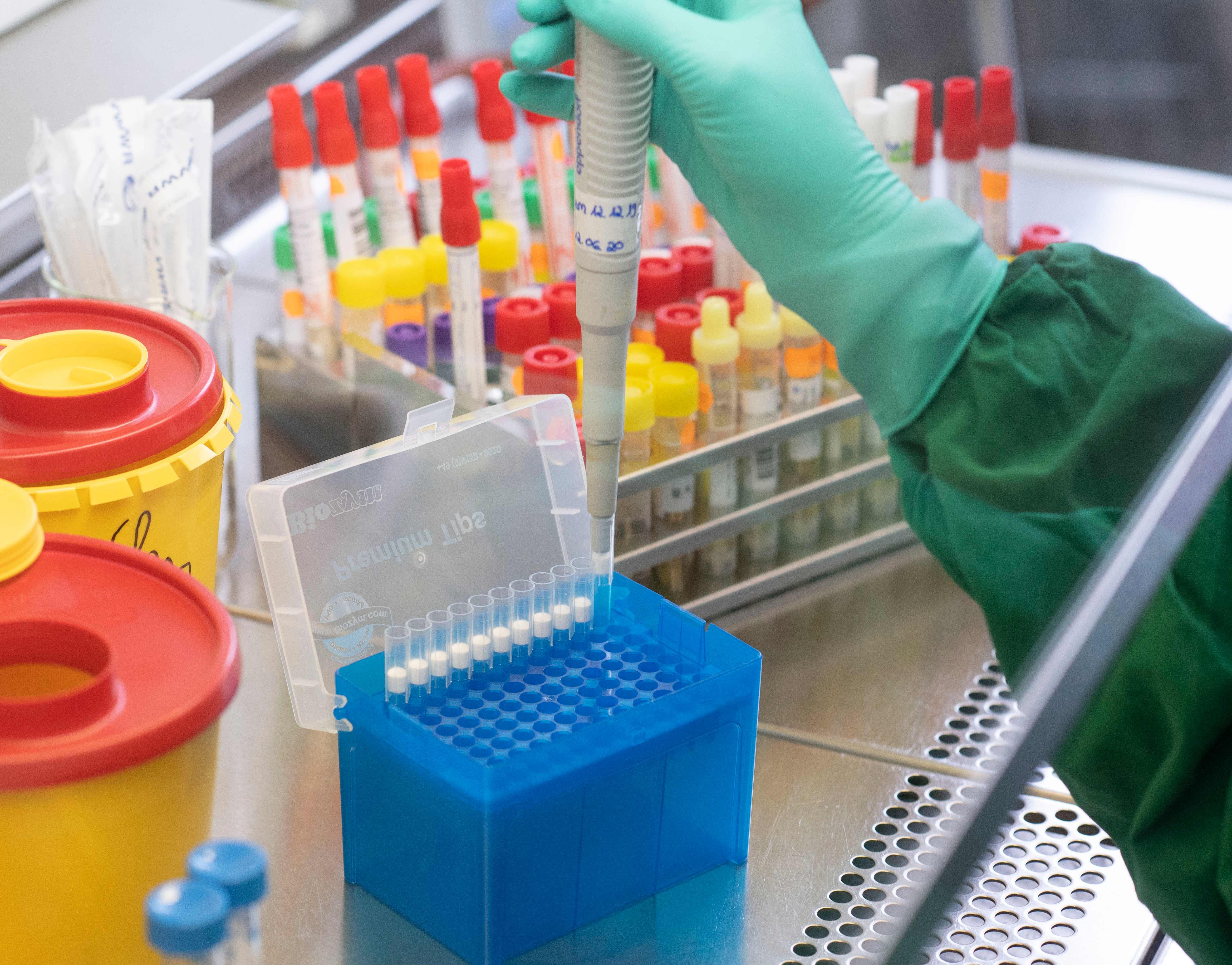 Peneliti menunjukkan spesimen negatif virus korona