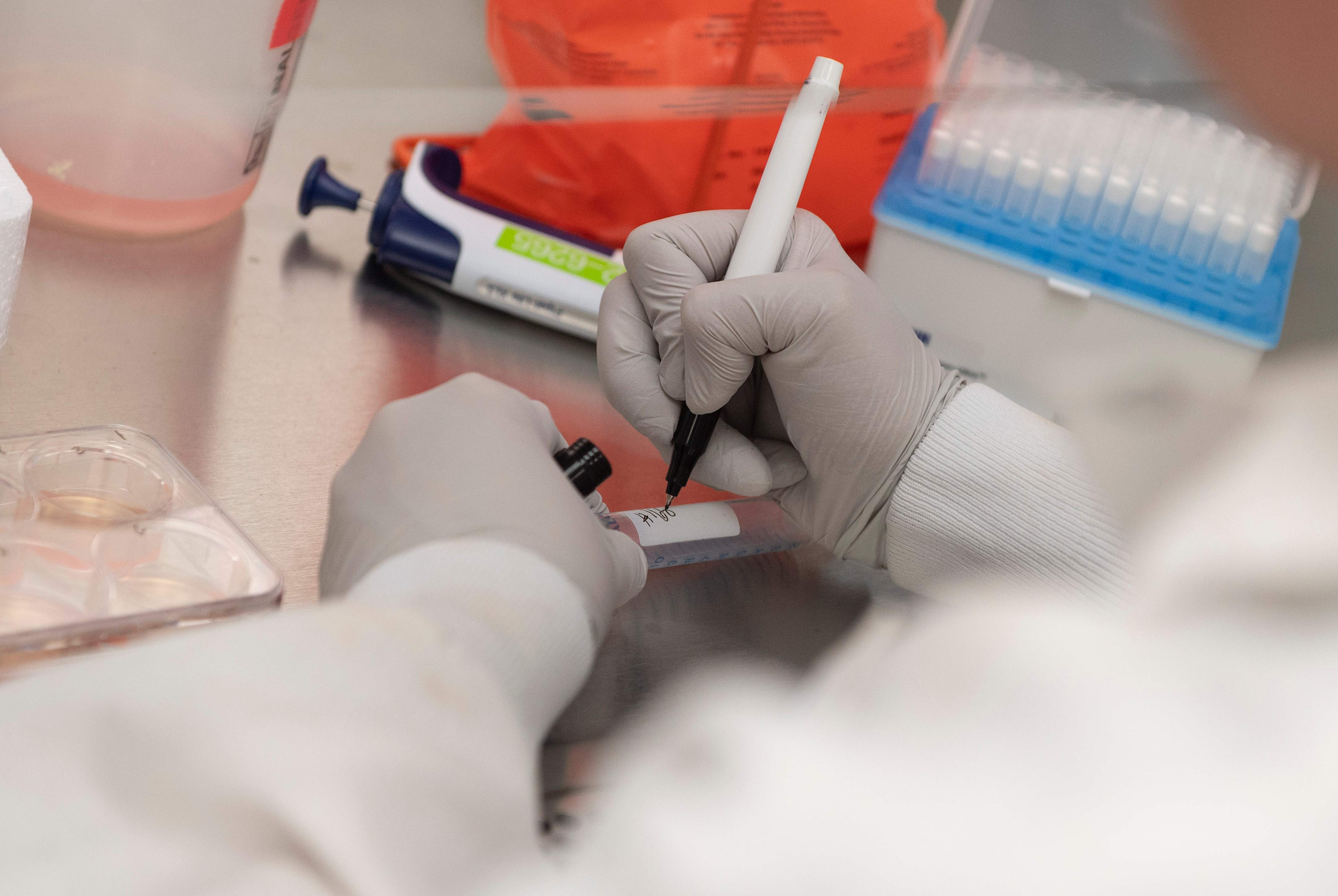 Ilmuwan sedang meneliti virus covid-19