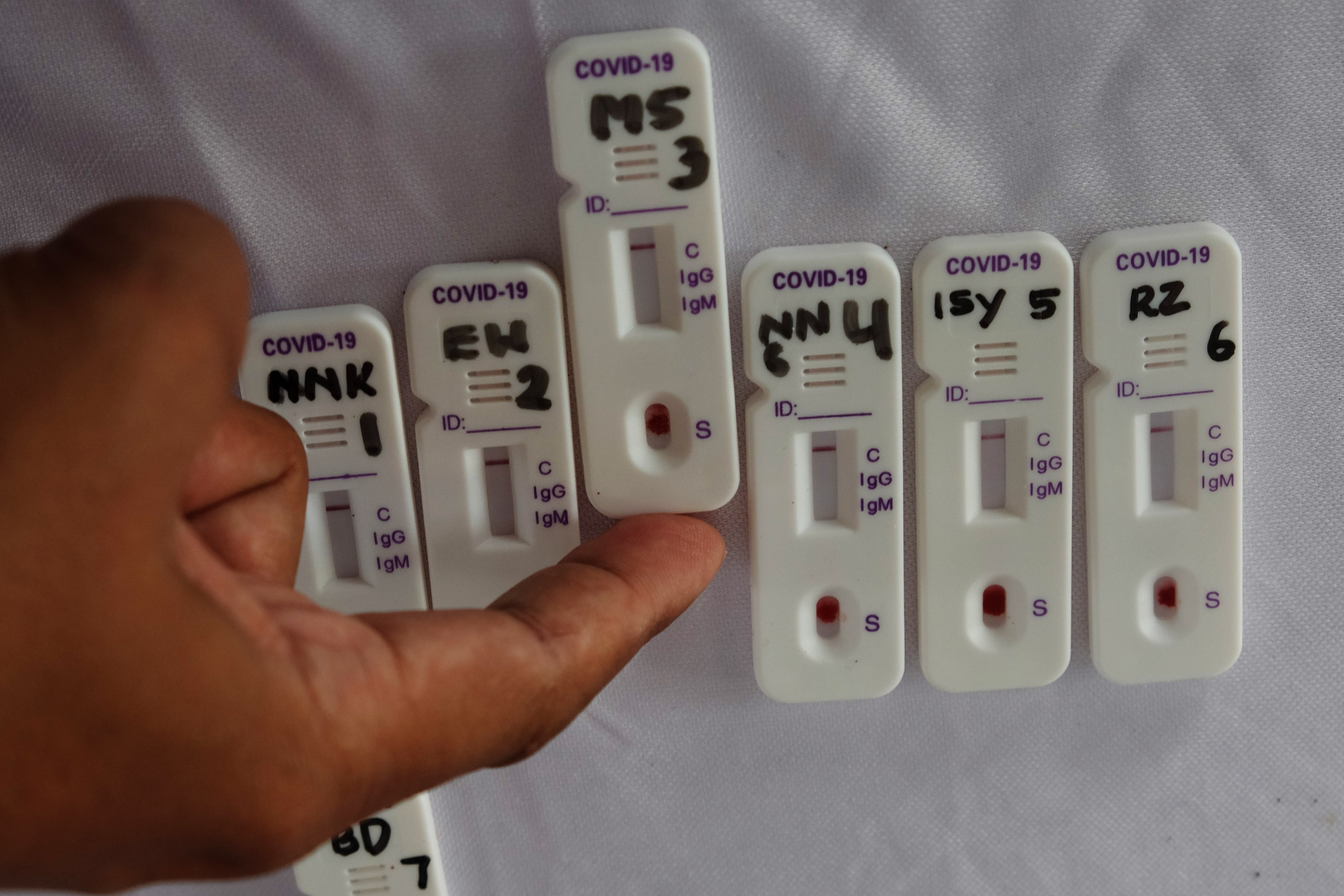 Pengujian sampel darah saat rapid test covid-19.