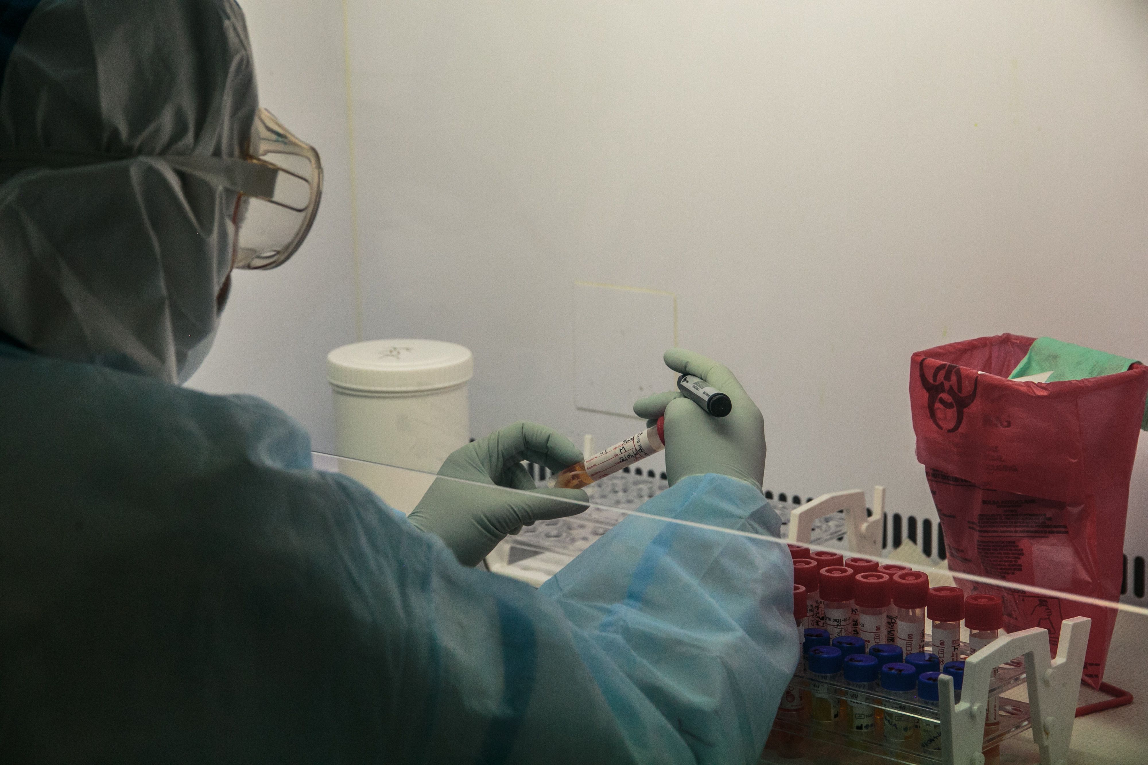 Polymerase Chain Reaction (PCR) Covid-19