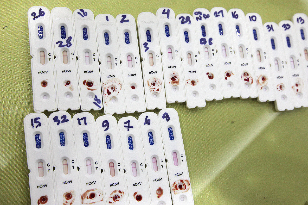 Beberapa hasil rapid test