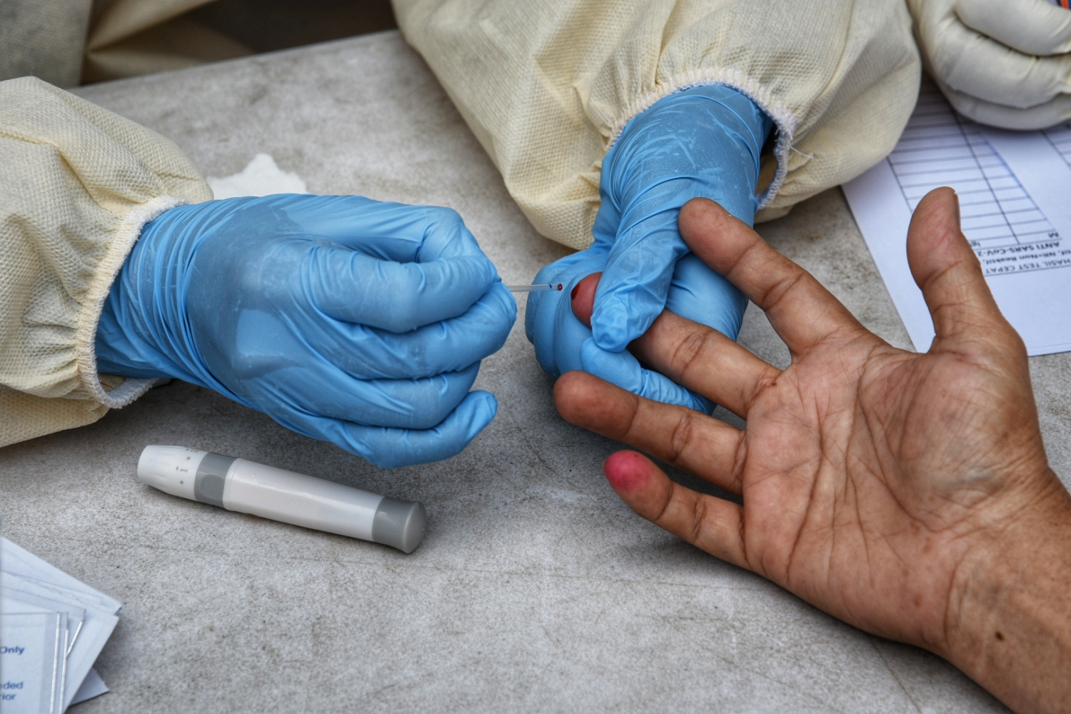 Penyembuhan korona dengan plasma darah bekas penderita