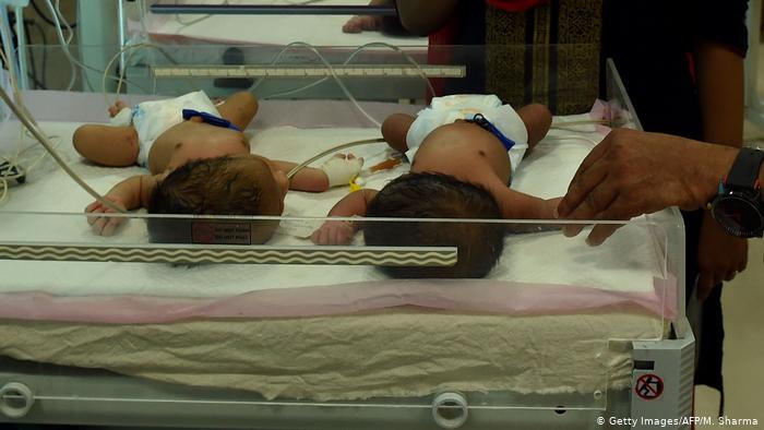 Pasangan Bayi Kembar Diberi Nama 'Corona' dan 'Covid' di India