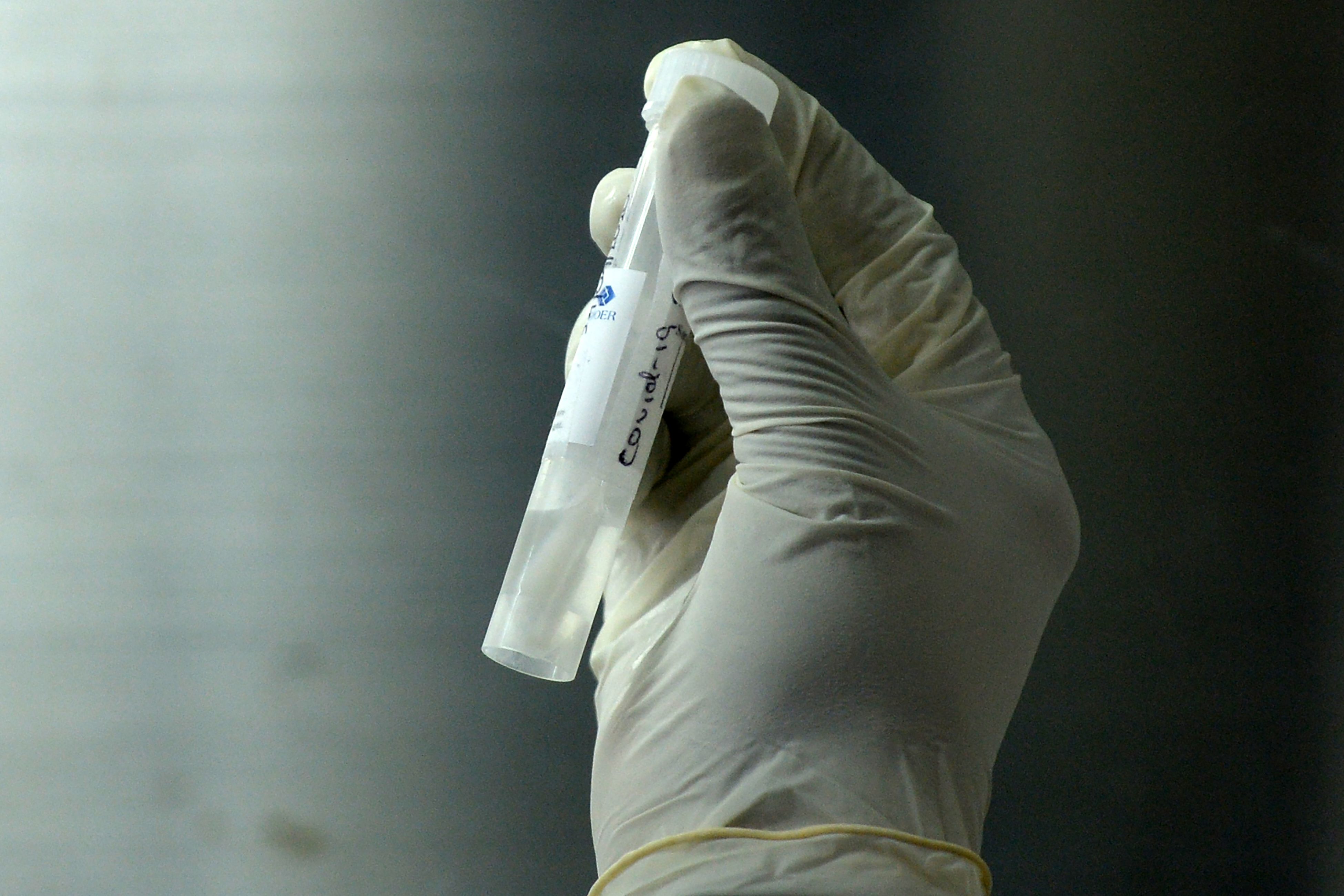 Polymerase chain reaction di Kotelawala defense univ hospital di Kolombo