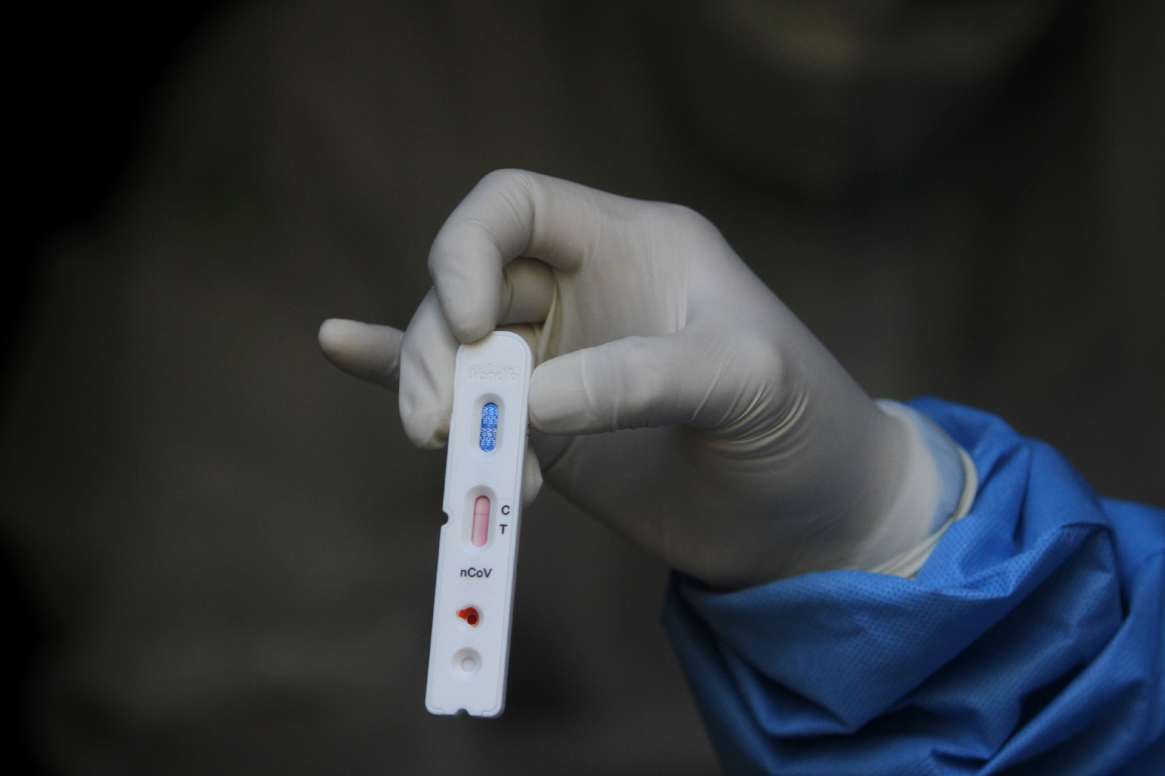 Petugas kesehatan menunjukkan sampel rapid test covid-19 di kawasan Pasar Sentra Antasari, Banjarmasin, Kalsel, Senin (4/5/2020).