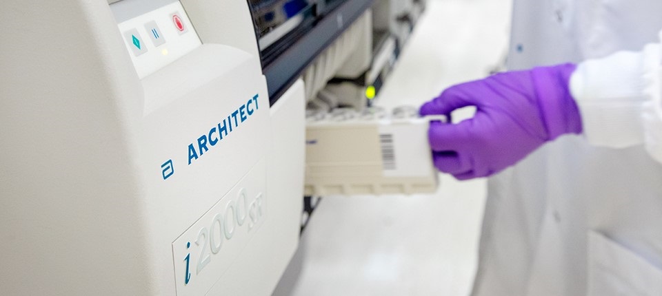 Ketersediaan alat tes IgG SARS-CoV-2 akan mendukung optimalisasi strategi penyaringan (screening).