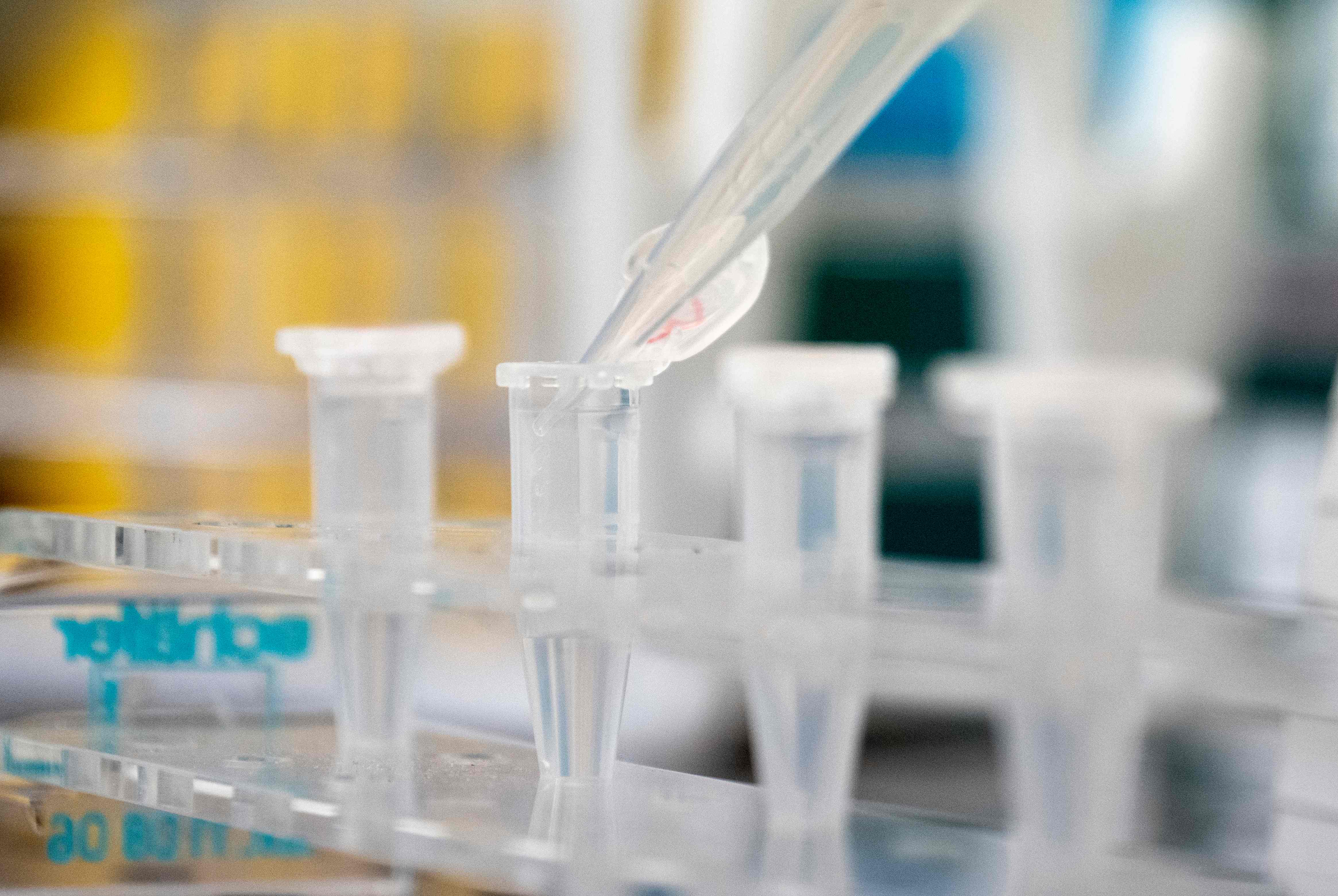 Laboratorium IAEA's Laboratories di Seibersdorf, Austria yang memeriksa spesimen dengan metode RT-PCR