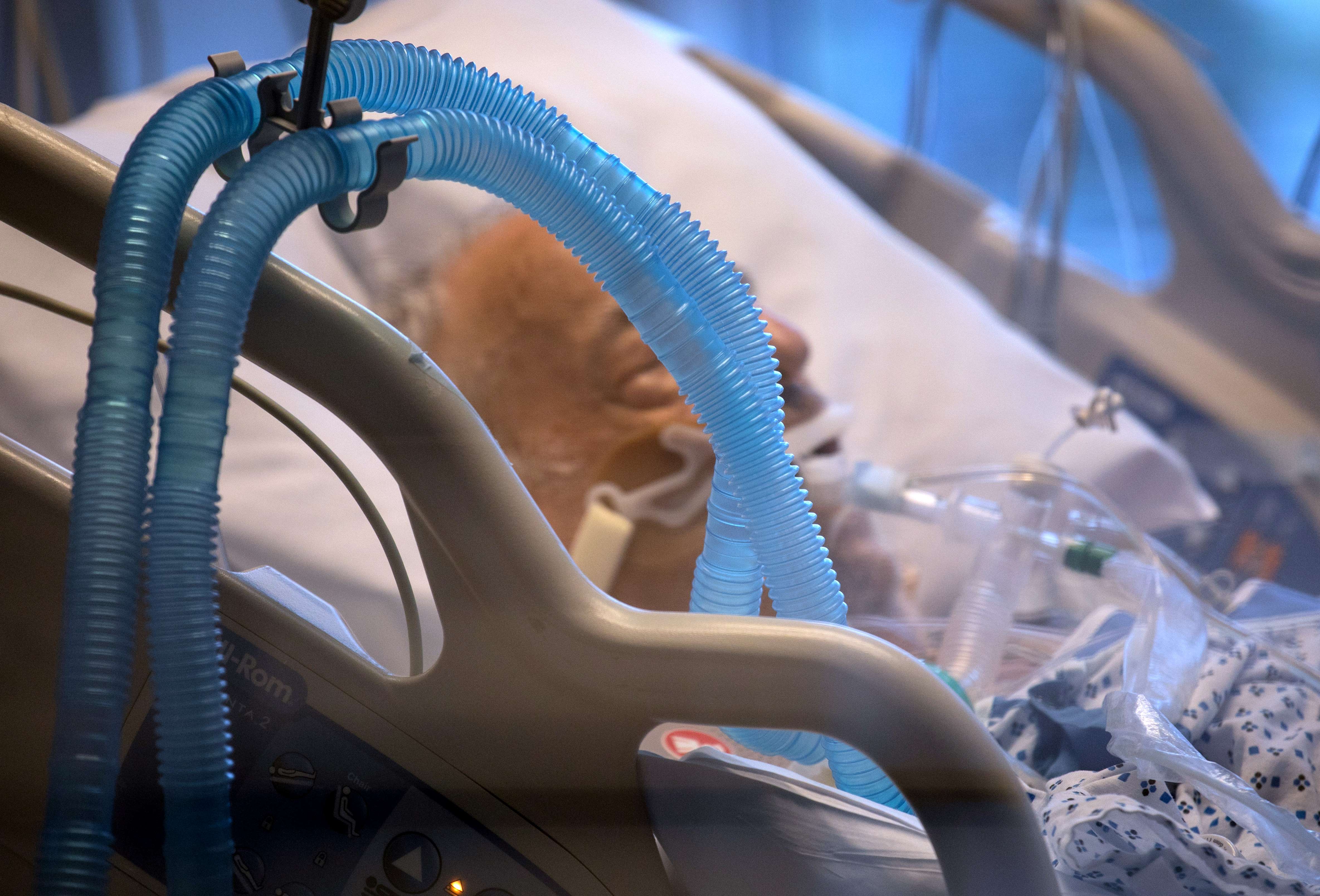 Seorang pasien covid-19 menggunakan alat bantu pernapasan berupa ventilator.