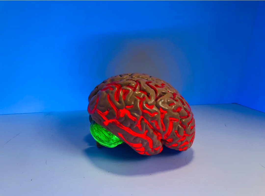 Penelitian tim dari Inggris menunjukkan jika berpikiran negatif terus-menerus menyebabkan terbentuknya protein berbahaya di otak.