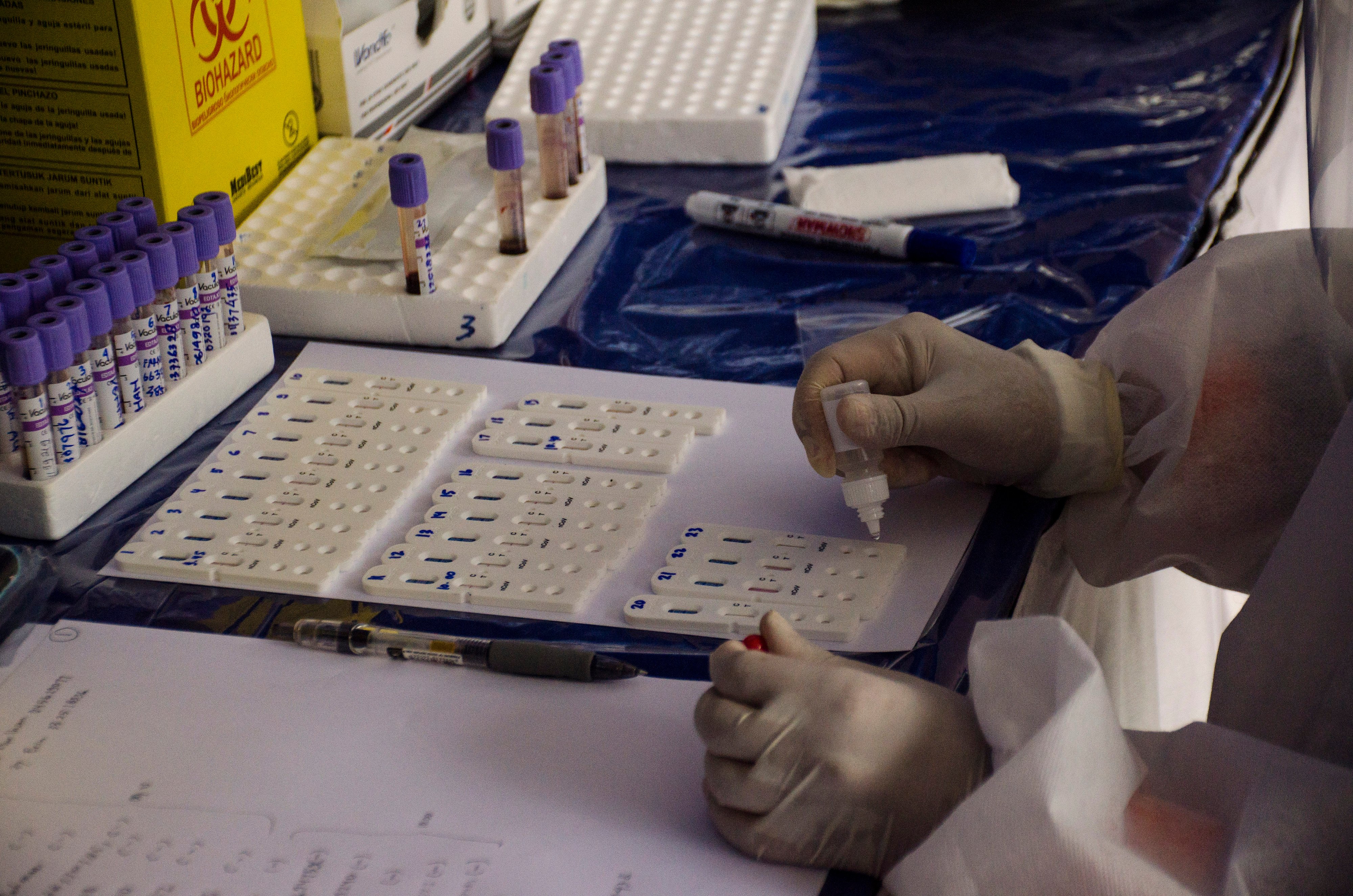 15 dari 36 tenaga kesehatan (nakes) positif Covid-19 di Bengkulu dinyatakan sembuh setelah dites melalui TCM swab