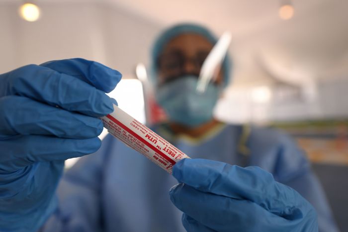 Ilustrasi petugas laboratorium yang menguji sampel kasus covid-19.  