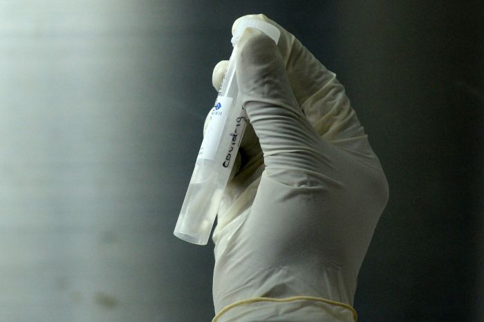 Iustrasi : PCR untuk diperiksa di laboratorium Univ Hospital di Kolombo.