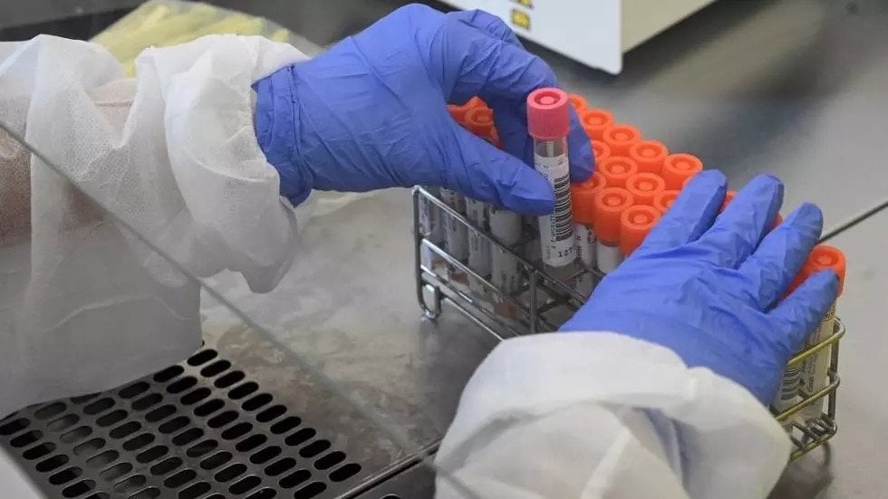 Dokter mengatakan pengobatan dengan antiinflamasi tocilizumab dapat menyelamatkan nyawa pasien Covid-19.