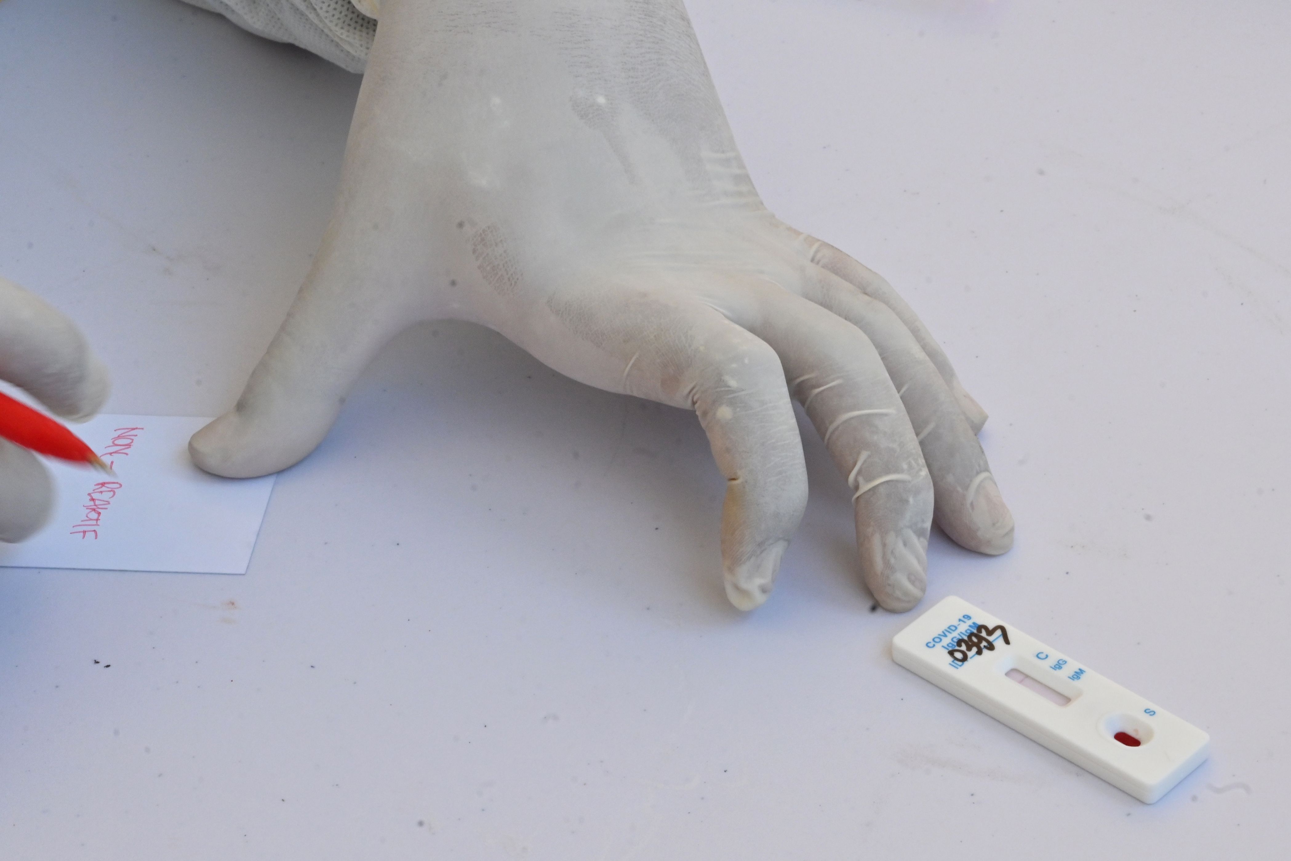 Petugas medis melakukan pendataan hasil rapid test antibodi Covid-19