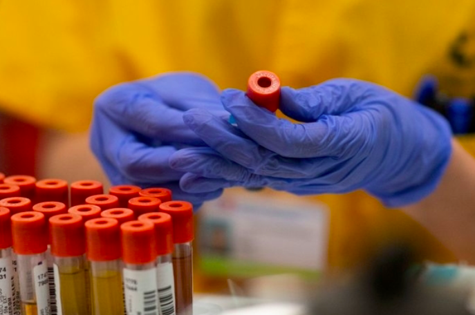 Ilustrasi -- Peneliti mencermati sampel tes covid-19.