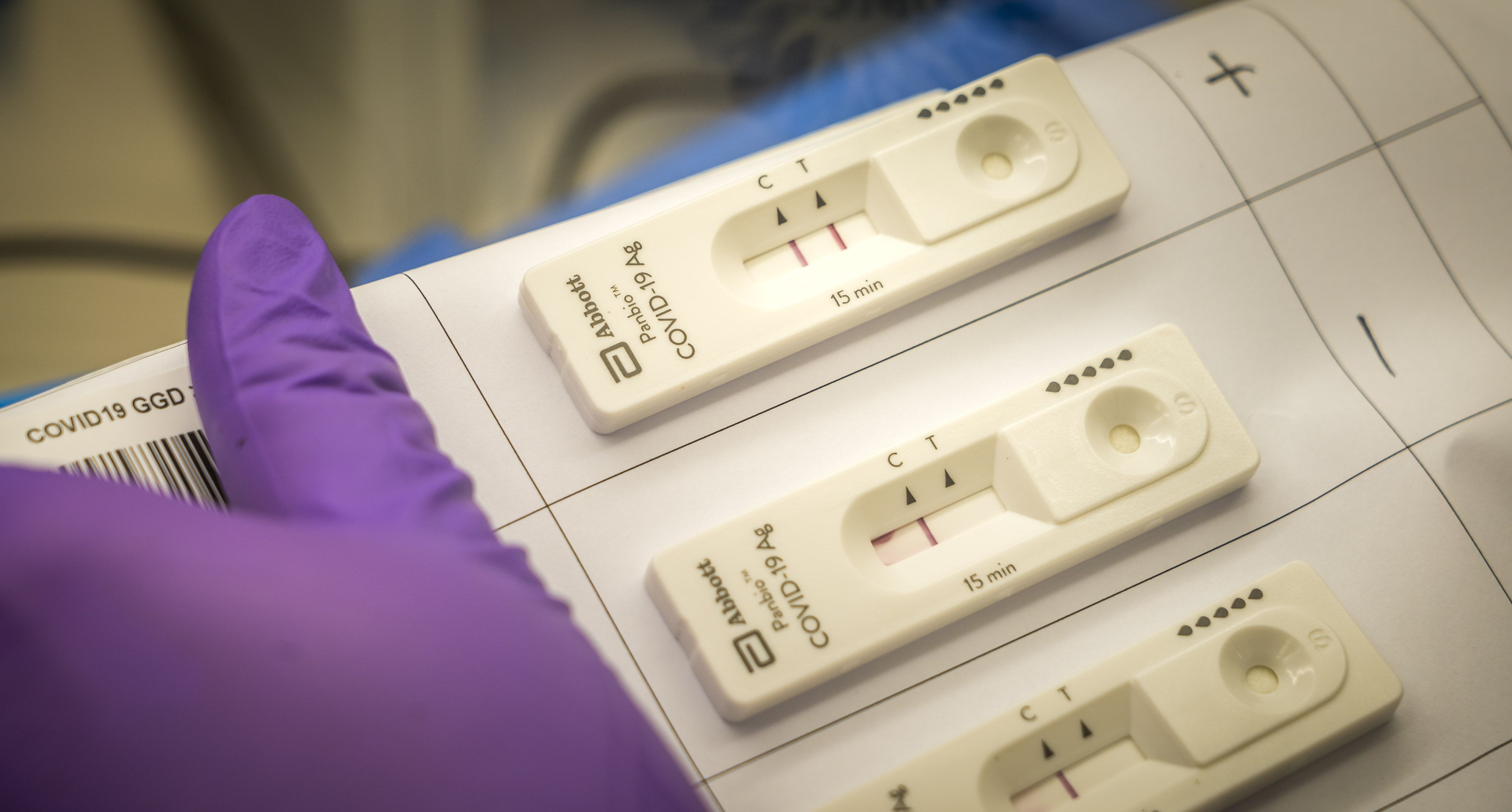 Seorang peneliti membandingkan hasil rapid test di UMC Utrecht, Utrecht, Belanda.