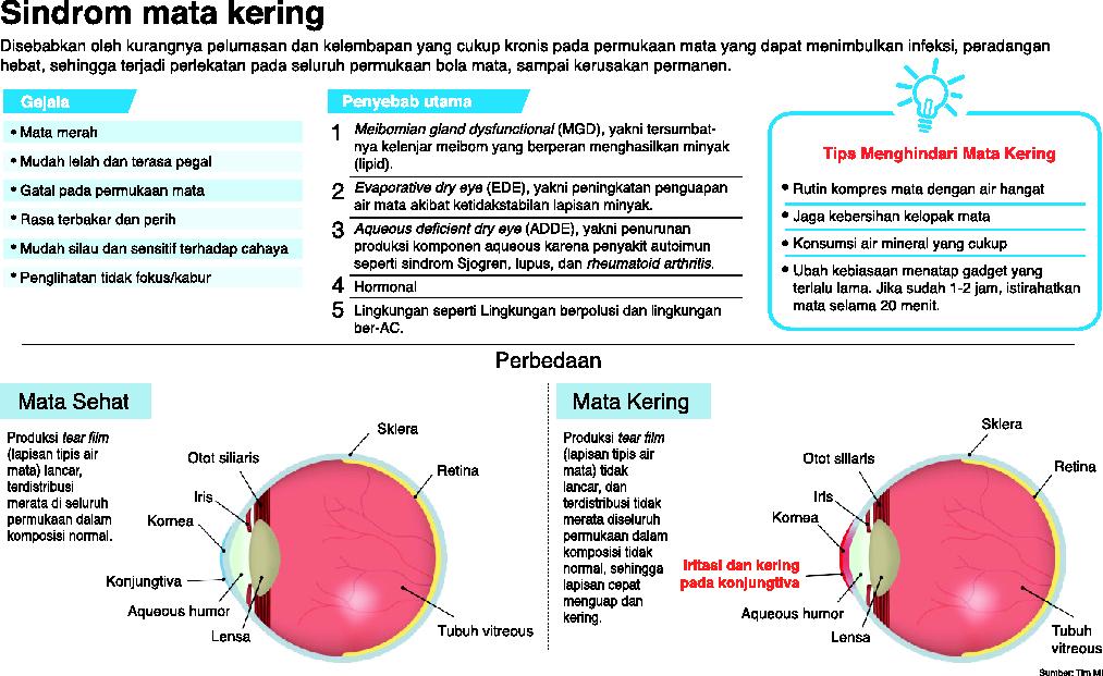 KESEHATAN: Sindrom Mata Kering