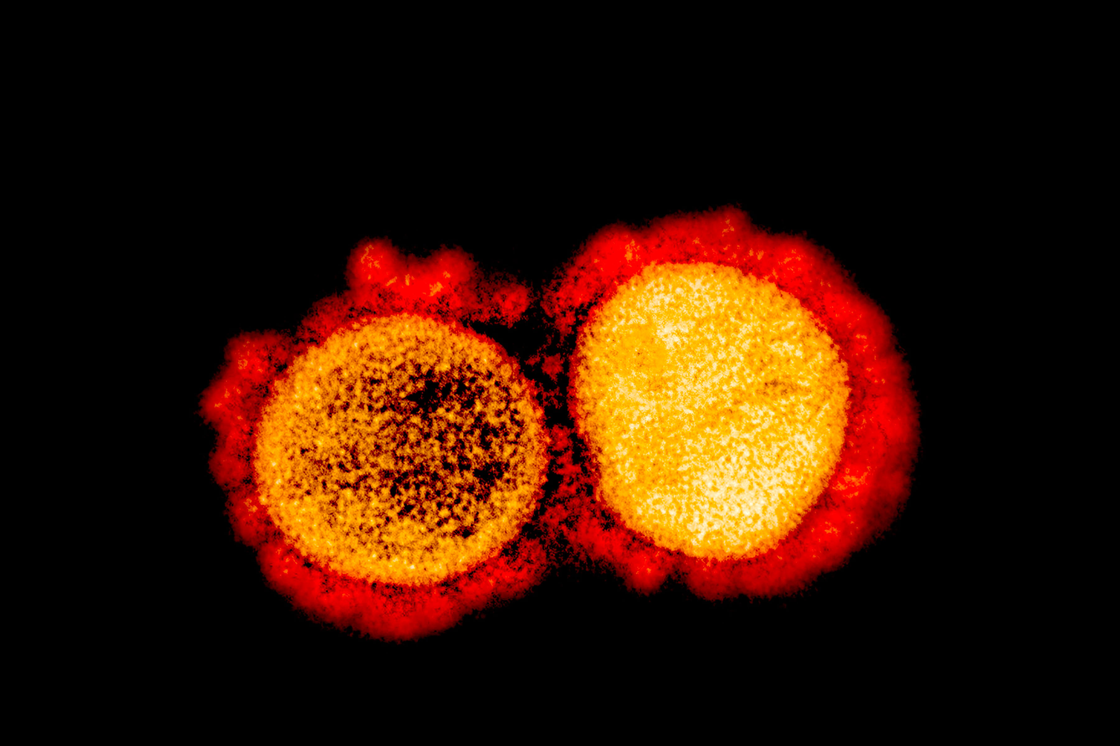 National Institute of Allergy and Infectious Diseases (NIH / NIAID), menunjukkan mikrograf elektron transmisi partikel virus SARS-CoV-2