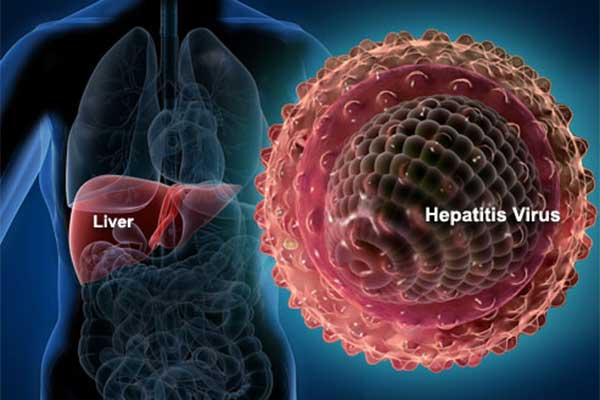 Ilustrasi hepatitis