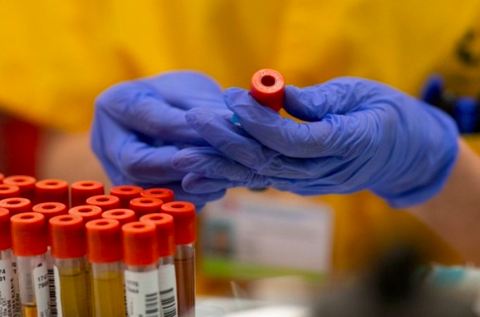 Ilustrasi -- Peneliti mencermati sampel tes covid-19