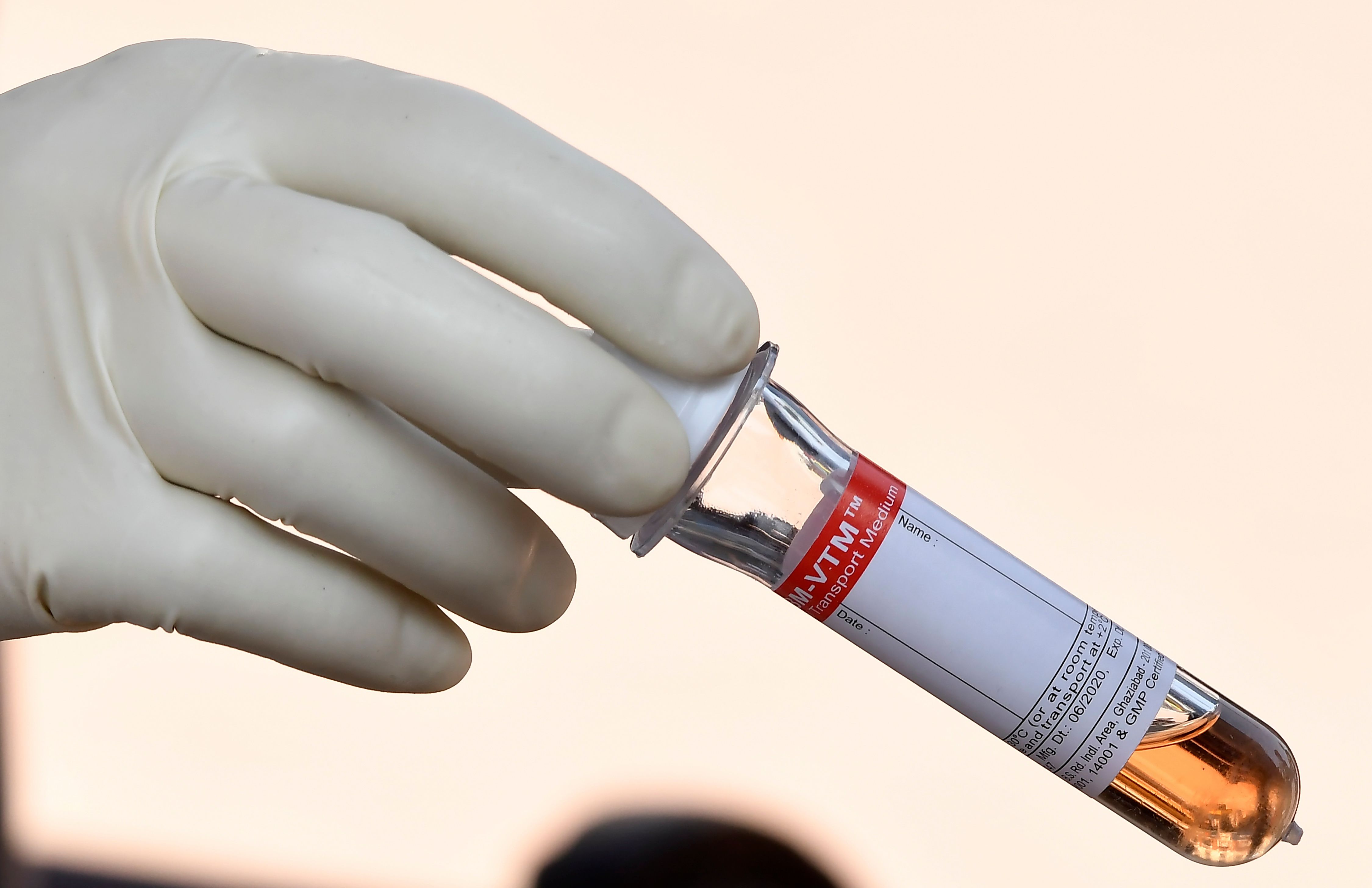 Spesimen hasil tes cepat antigen